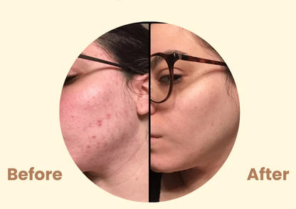 Black Tea Mask (Buy 1 Get 1 Free)