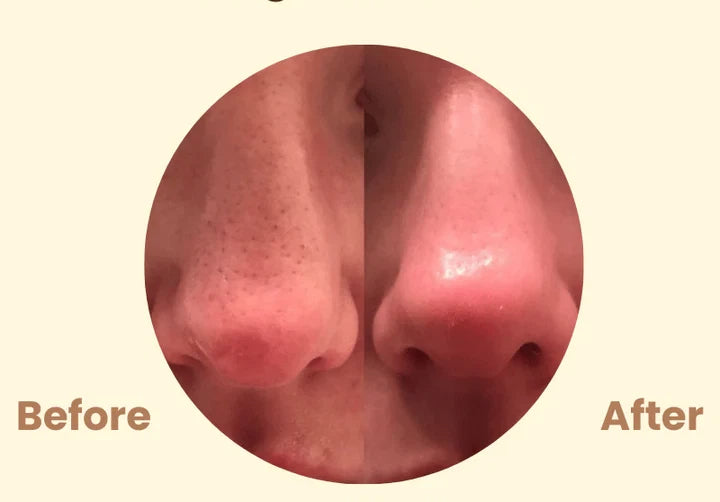 Black Tea Mask (Buy 1 Get 1 Free)