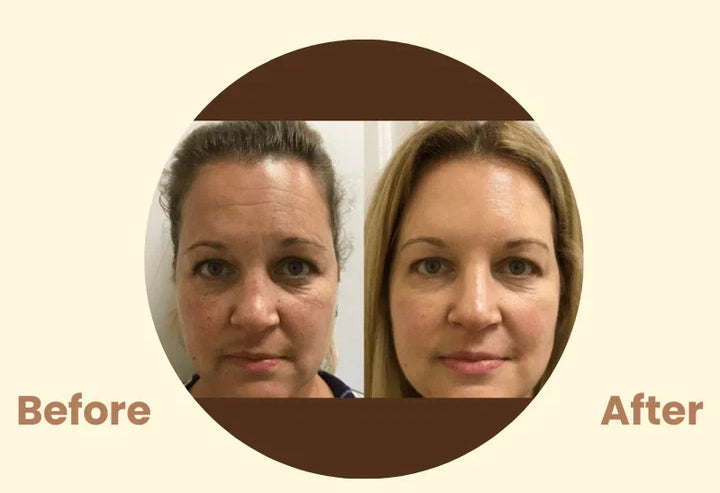 Black Tea Mask (Buy 1 Get 1 Free)