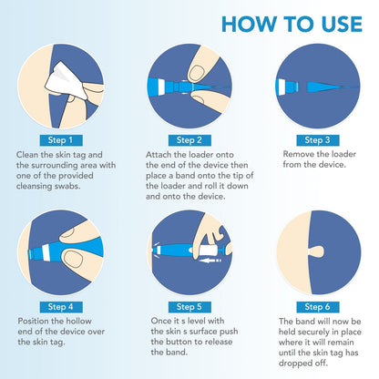 Wart Removal Pen (10 free alcohol pads)