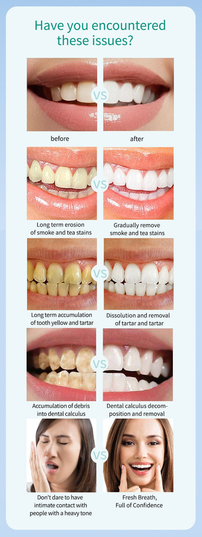 Buy 1 Get 1 Free | Whitening Foam Toothpaste | Remove Stains, Whiten Teeth | Fresh Breath, Natural & Safe