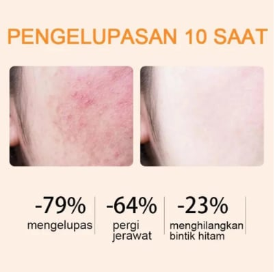 Buy 1 Get 1 Free | Glow Enzyme Gel - A Miracle for Gentle Skin Care